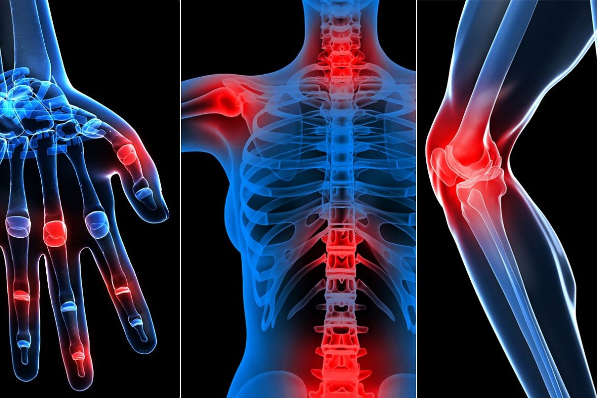 cel mai bun tratament pentru artroza gleznei articulațiile doare după sală